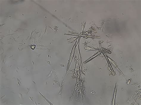 renal obstruction Archives - Medical Notes