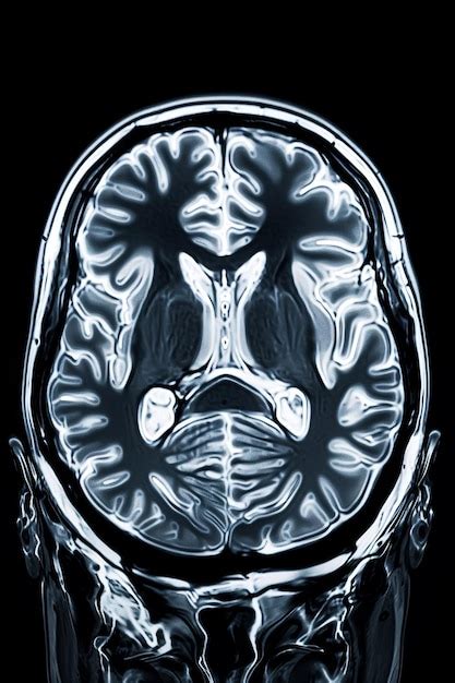 High Res Brain Scan Image 的图像结果