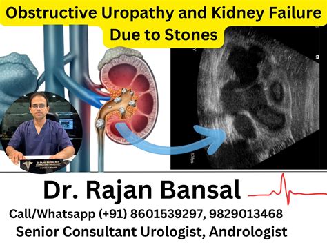 What is Partial Nephrectomy?