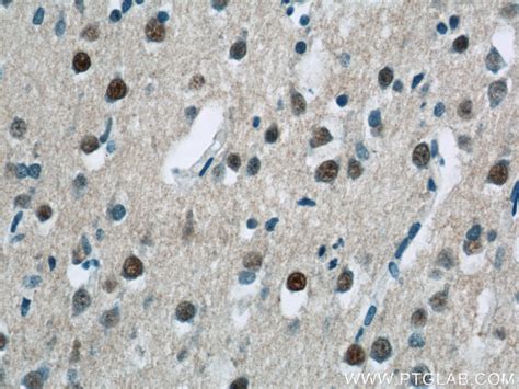 USP11 antibody (22340-1-AP) | Proteintech