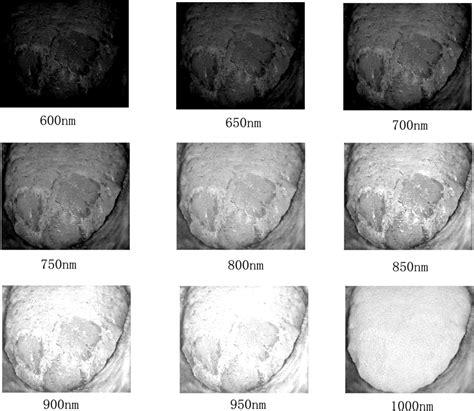 Tongue Tumor Detection in Medical Hyperspectral Images