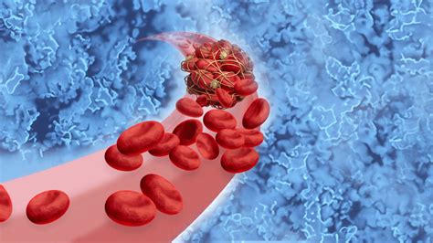 Image result for Heparin Problems