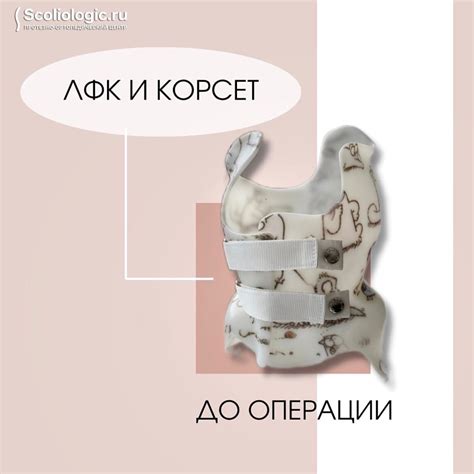 ЛФК и корсет ДО операции при сколиозе | Протезно-ортопедический центр ...