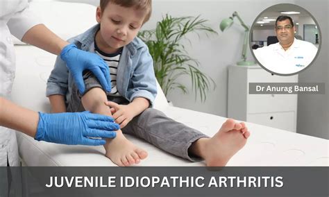 Juvenile Idiopathic Arthritis: Symptoms, Diagnosis and Treatment- Dr ...