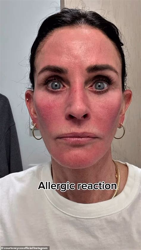 Courteney Cox gives her fans a little scare when they see her with a damaged face in her latest ...