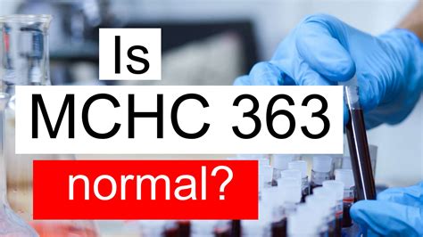 Is Serum MCHC 363 high, normal or dangerous? What does Serum MCHC level 363 mean?