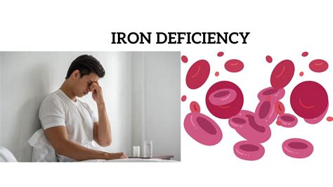 What Are The 3 Stages of Iron Deficiency? | Credihealth