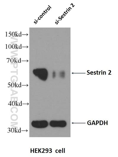Sestrin 2 antibody (10795-1-AP) | Proteintech