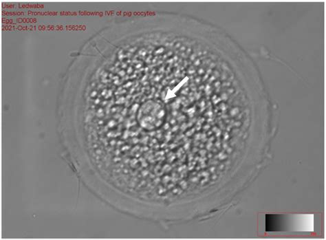 Investigation of the Efficacy of Dithiothreitol and Glutathione on In ...