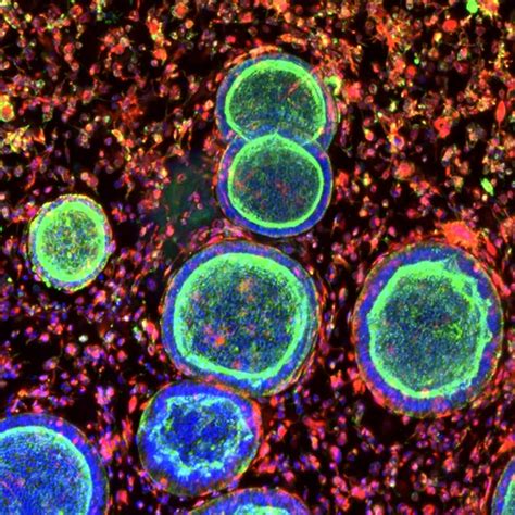 Lab-Grown Organoids Could Transform Female Reproductive Medicine ...