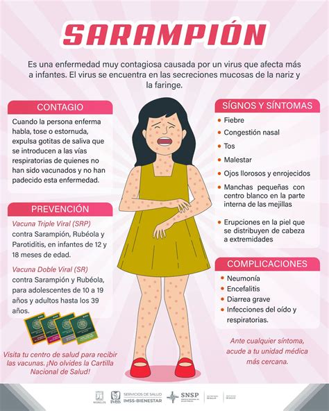 Comparte HNM información sobre síntomas de Sarampión - Zona Centro Noticias