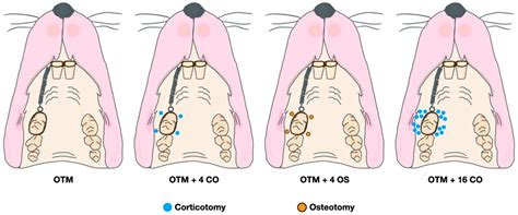 Effect of Extending Corticotomy Depth to Trabecular Bone on ...