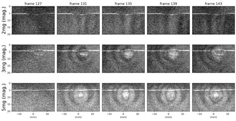 Ultrasound B-Mode Visualization of Imperceptible Subwavelength ...