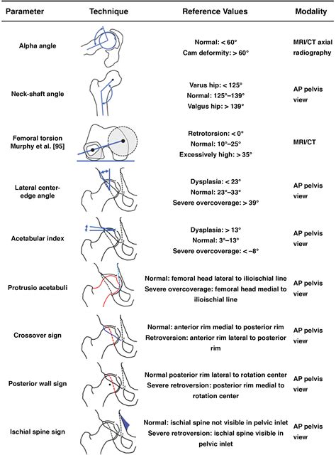Cam-Type Femoroacetabular Impingement Radiology at Maria Kring blog