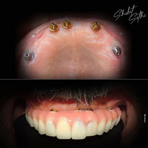 Best Dentist in Chandigarh, Best Dental Clinic and Orthodontist