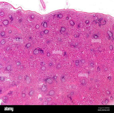 Light microscopy of primate spleen showing white pulp (blue) and red ...