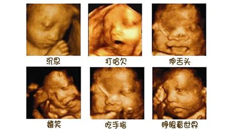 四维彩超怎么分辨胎儿是男是女？-全查网