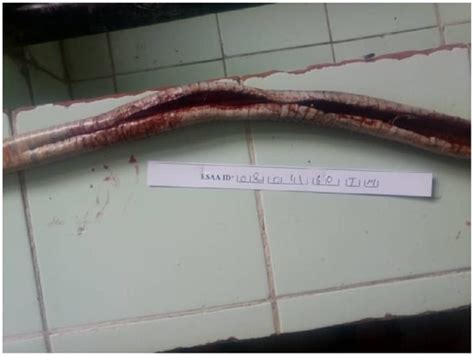 Tropical Medicine and Infectious Disease | An Open Access Journal from MDPI