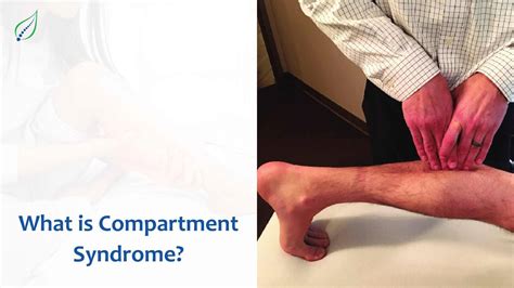 Compartment Syndrome: Causes, Symptoms, and Treatment | Best Back Pain, Slip Disc, Knee ...