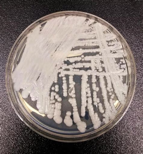 “超级真菌”是怎样炼成的？-黄广华课题组在临床耳念珠菌感染和传播机制方面取得重要进展