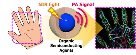 Recent Progress on Near-Infrared Photoacoustic Imaging: Imaging ...