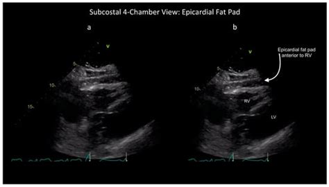 Diagnostics | Special Issue : Current Challenges and Perspectives of ...