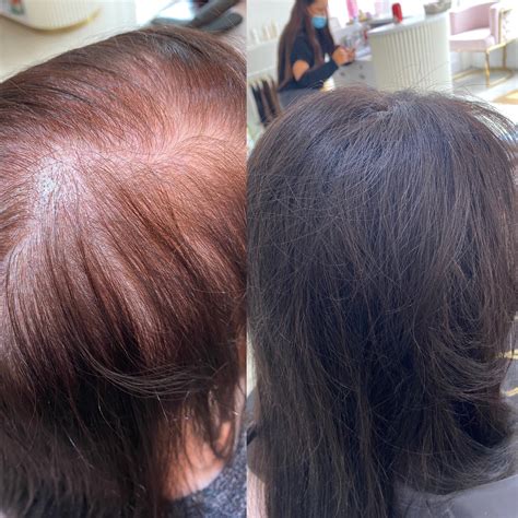 Mesh Integration Hair Loss - 2 Day Training Event - Jaclyn Moss Hair