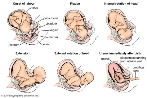 Birth: Fetal Presentations and Complications of Delivery