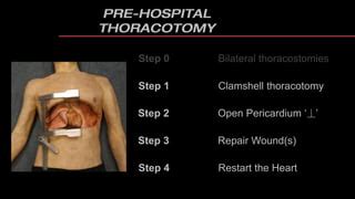 Image result for Clamshell Thoracotomy Cartoon