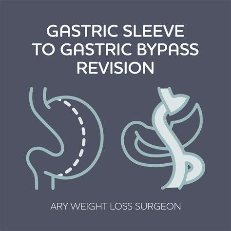 Weight Loss Procedures – AryBariatrics