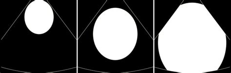 Image result for Ultrasound Scanner Depth Control