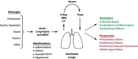 Image result for Ali vs Ards PaO2/FiO2