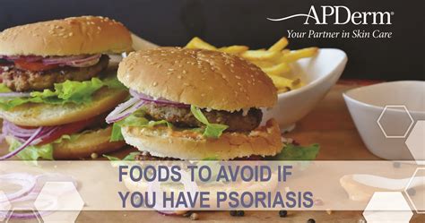 Foods To Avoid with Psoriasis | APDerm