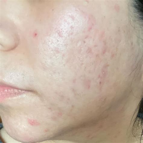 Maria | Licensed Esthetician | THE SWEAT IS ON YOU, THE CLASS IS ON ME ...