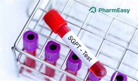 एसजीपीटी टेस्ट (SGPT Test in Hindi): क्या है, कैसे होता है | PharmEasy