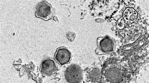 Giant Viruses Capable Of Destroying Marine Life Discovered In Depths Of ...
