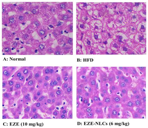 Ezetimibe-Loaded Nanostructured Lipid Carrier Based Formulation ...