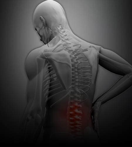 Minimally Invasive Spine Surgery | Aster