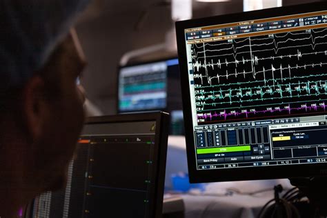 Image result for Loop Recorder Extraction