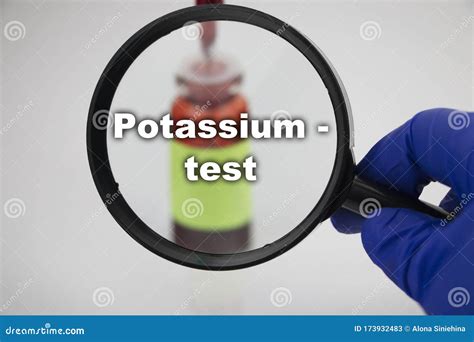 A Blood Sample for a Test for Potassium. the Doctorâ€™s Hand Holds a ...