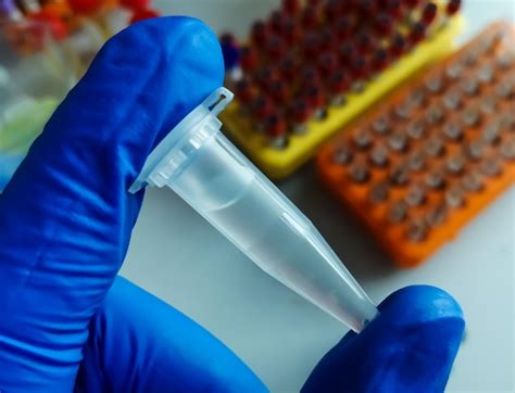 Image result for CSF Sample Syringe