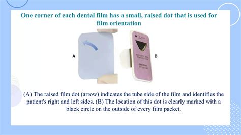 Dental X-Ray Film types and indications. | PPTX