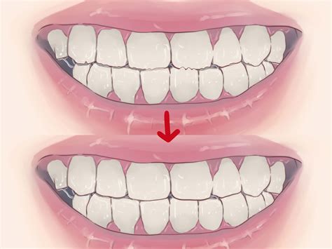 How To Stop 16 Month Old From Grinding Teeth at Randy Stambaugh blog