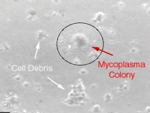 name the smallest cell in nature? - Brainly.in
