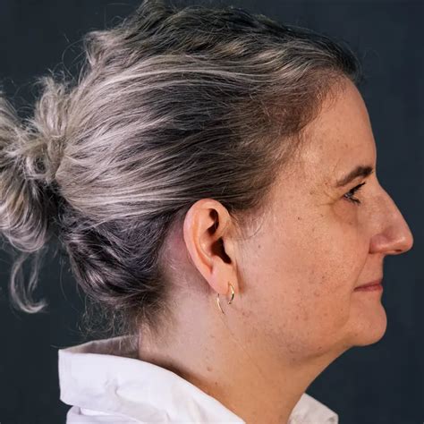 Image result for ReSound Key 267Bte