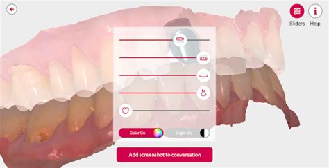 Image result for 3Shape Communicate Tutorial