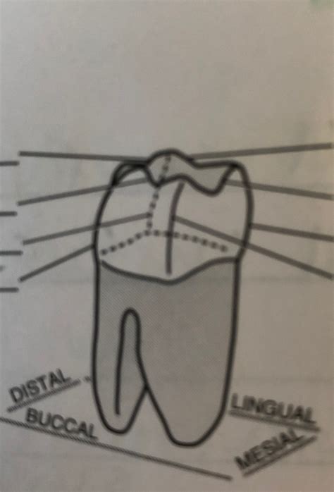 Line Angle Teeth 的图像结果