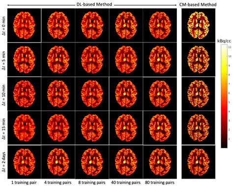 Dual-Tracer PET Image Separation by Deep Learning: A Simulation Study