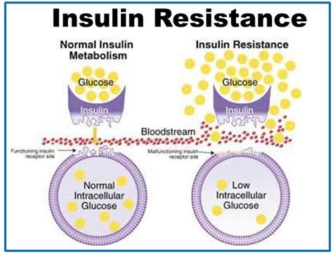 Image result for Insulin Management Algorithm