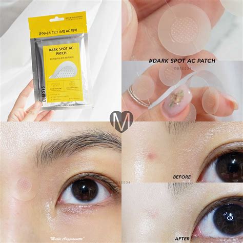 Curesys Dark Spot Ac Patch (9PCS) | LINE SHOPPING